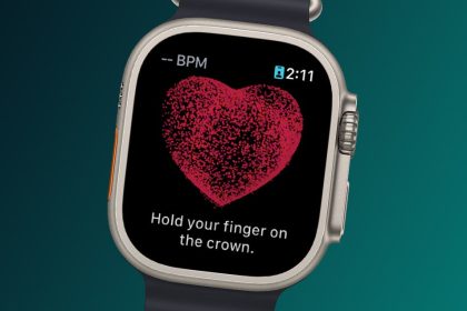 1713762077 So beheben Sie dass das EKG der Apple Watch nicht
