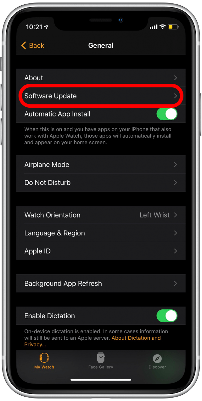 Appuyez sur Mise à jour du logiciel pour réessayer la mise à jour Apple Watch